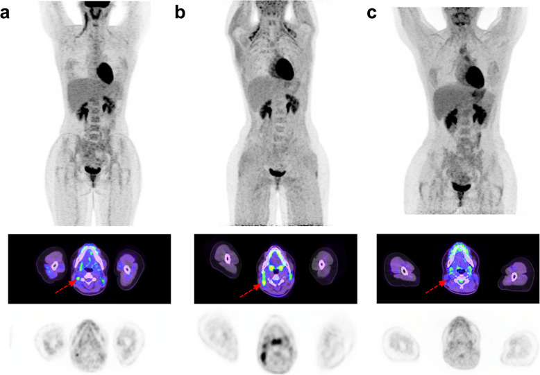 Fig. 2