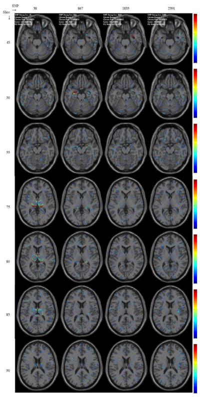 Fig. 11