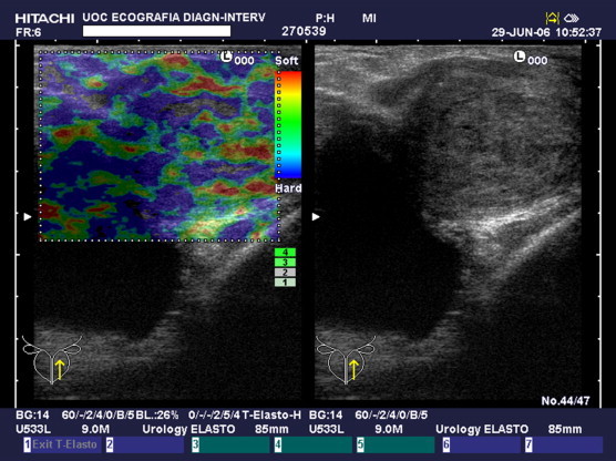 Fig. 3