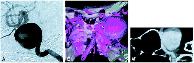 fig 3.