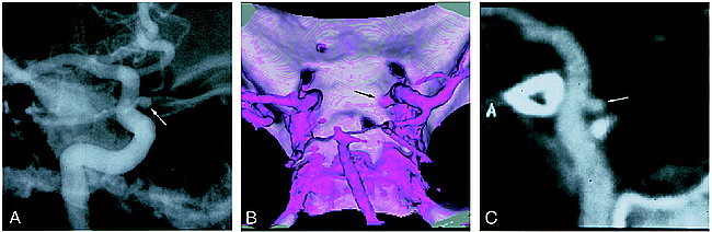 fig 2.