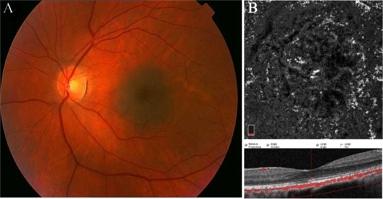 Fig. 1