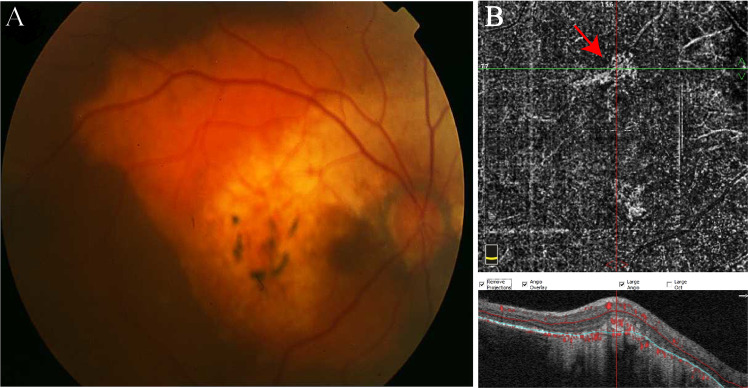 Fig. 7