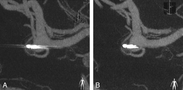 Fig 8.