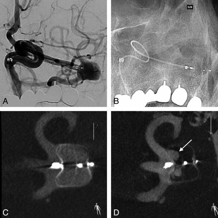 Fig 3.