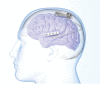 Fig. 10