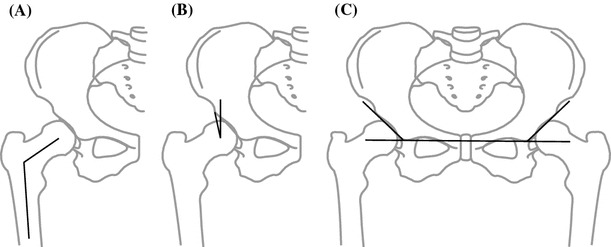 Fig. 1