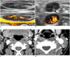 Fig. 9