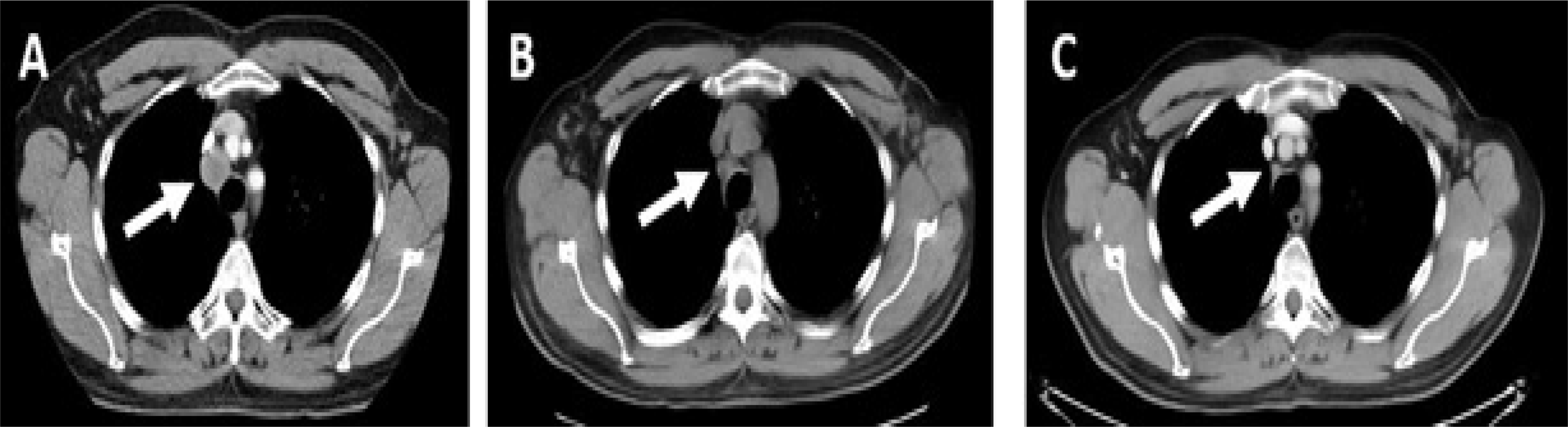 Figure 2: