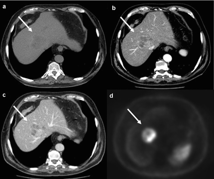 Fig. 9