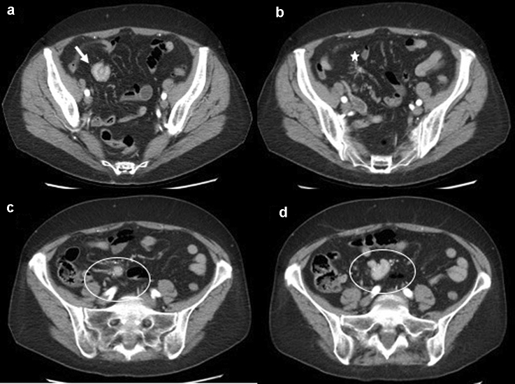 Fig. 5