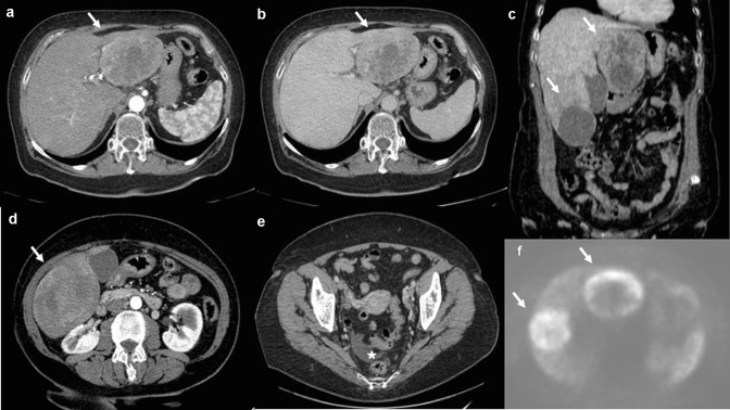 Fig. 8