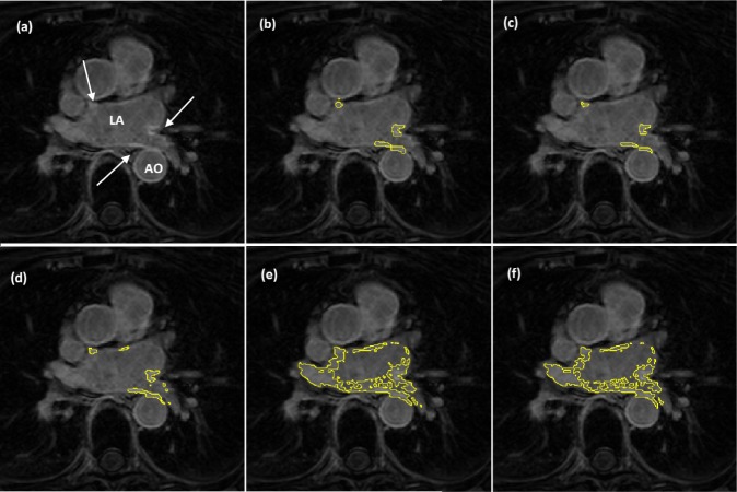 Fig. 16.