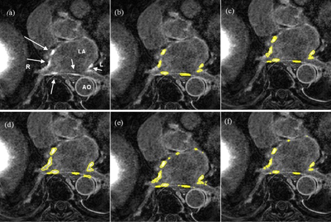 Fig. 15.