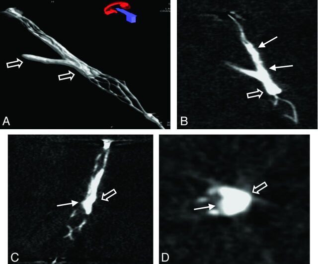 Fig 3.