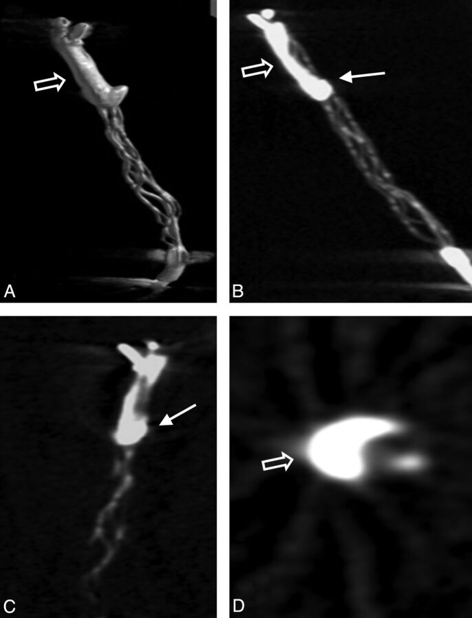 Fig 2.