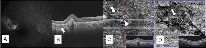 Figure 2