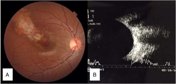 Figure 1