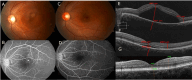 Fig. 3