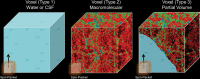 Voxel types according to spatial scalability. Three different voxel types
with increasing inner complexity from left to right (simulation colors: blue =
cerebrospinal fluid [CSF], red = gray matter [GM], green = white matter [WM]).
Type 1, which contains pure CSF (left), is fully scalable, meaning that the
quantitative MRI (qMRI) parameters at the spin-packet and voxel scales are
equal. Type 2 voxels contain a typical structured soft tissue (eg, WM or GM),
leading to a distribution of correlation times and magnetization transfer
effects, as reviewed in the text. Type 3 voxels are difficult for qMRI
algorithms because of partial volume effects.