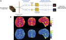 Schematic overview of the convolutional neural networks model with two
modules for tissue property mapping. (A) The feature extraction module
consists of four fully connected layers (FNNs), which is designed to mimic
singular value decomposition to reduce the dimension of signal evolutions.
The U-Net structure was used for the spatially constrained quantification
module to capture spatial information from neighboring pixels for improved
quantification of tissue properties. MR fingerprinting (MRF) images of three
contiguous sections (red) were used as input, and the corresponding
reference T1 and T2 maps from the central section were used as output for
the network. (B) Reformatted quantitative maps in axial, coronal, and
sagittal views from the prospectively accelerated scan (three-dimensional
MRF, standard; R = 2; 192 time points). The acquisition time for 176
sections was about 7 minutes. (From reference 20. Note: The referenced
article is available under the Creative Commons CC-BY-NC-ND license, which
permits noncommercial use of the work as published, without adaptation or
alteration, provided the work is fully attributed.)