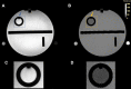 Partial volume artifacts. (A) T1-weighted image is compared with (B) the
corresponding T1 map of the American College of Radiology MRI accreditation
phantom. The arrows and outlines in A and B correspond to the magnifications in
(C) and (D), respectively. Even though the T1 map has less intensity variation,
bright pixels near the edges (see magnifications) result in a less natural
appearance. As discussed in the text, improving the visual appearance of
quantitative MRI (qMRI) maps is very important for the clinical adoption of
qMRI.