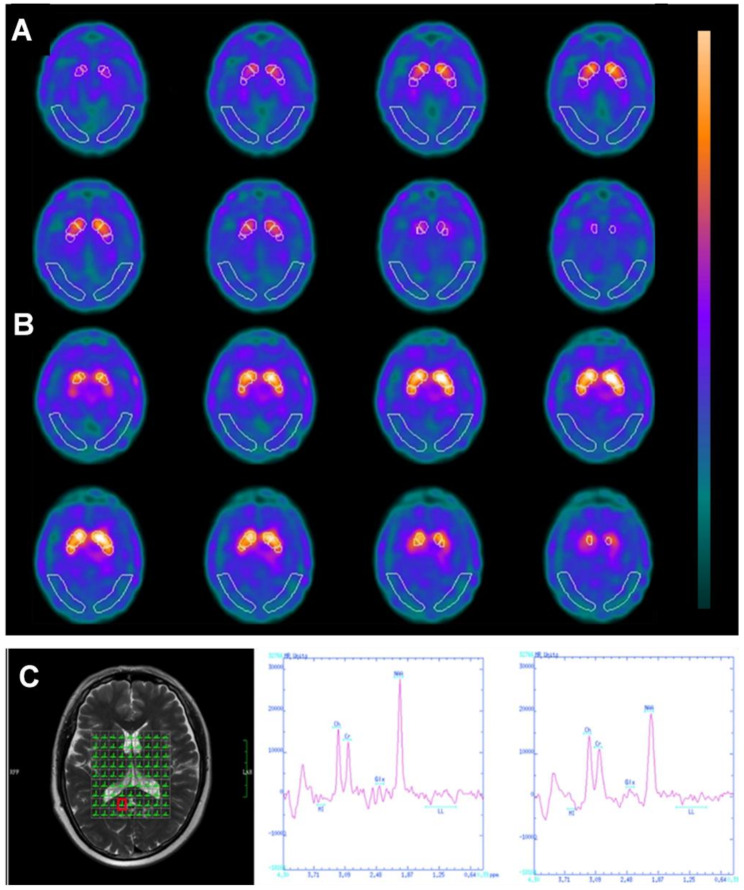 Fig. 4