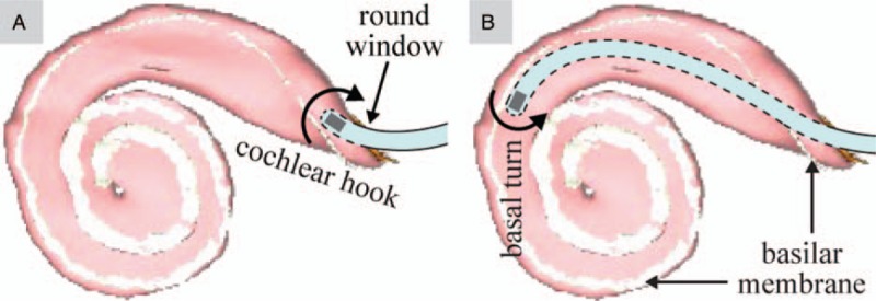 FIG. 1