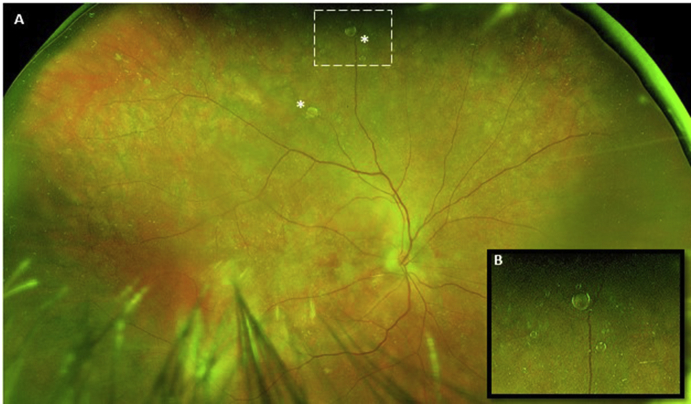 Fig. 1