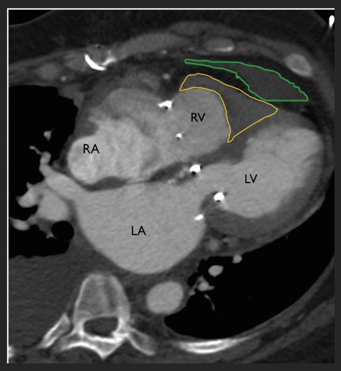 Figure 2