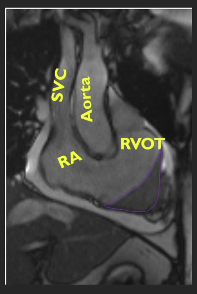 Figure 4