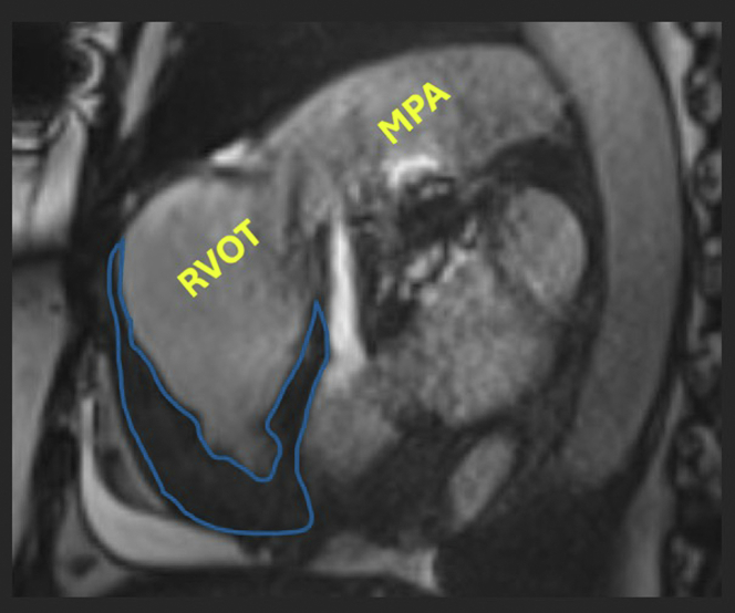 Figure 5