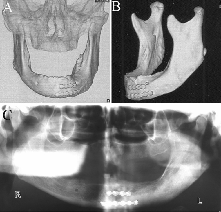 Fig. 5