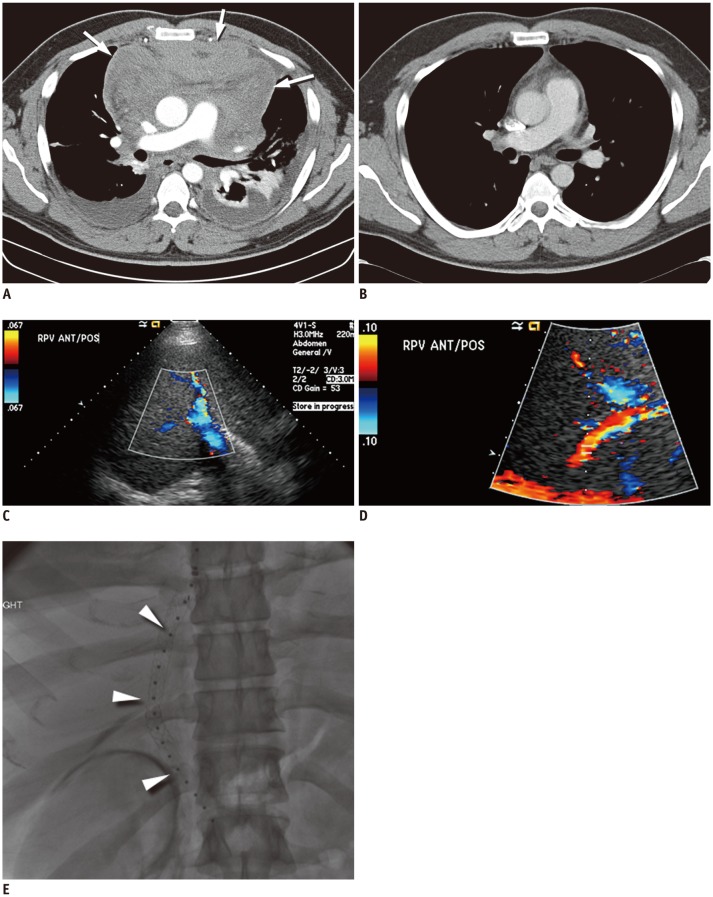 Fig. 10