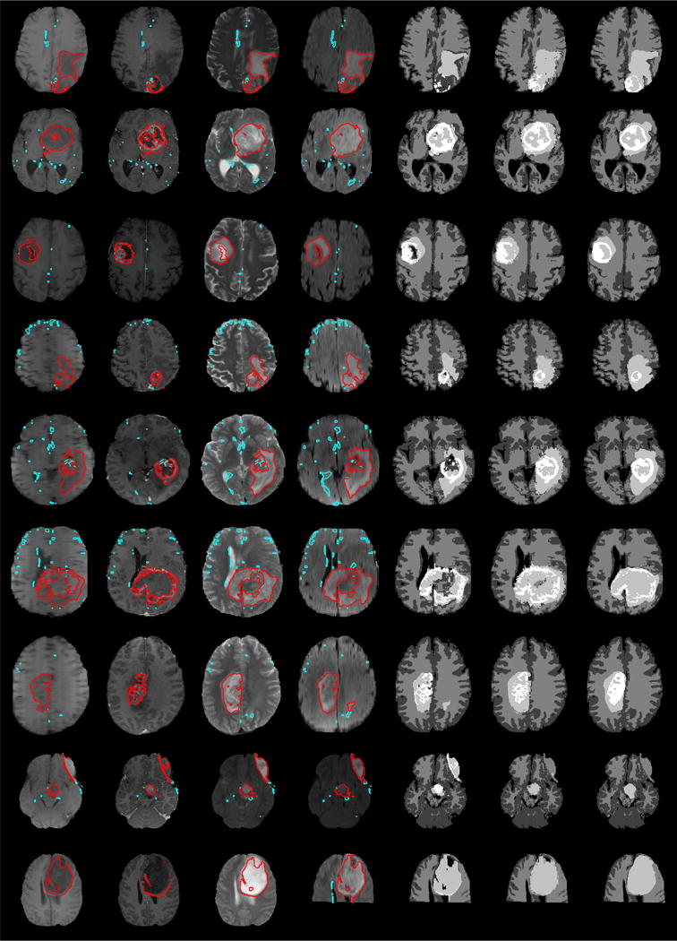 Fig. 4