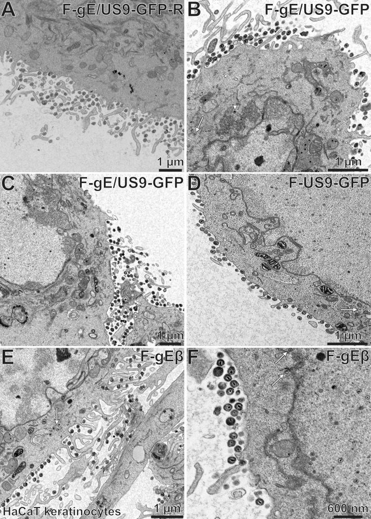 FIG 13