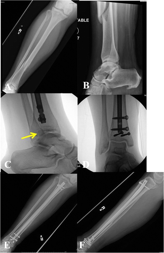 Fig. 2