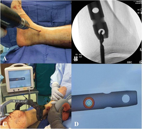 Fig. 12