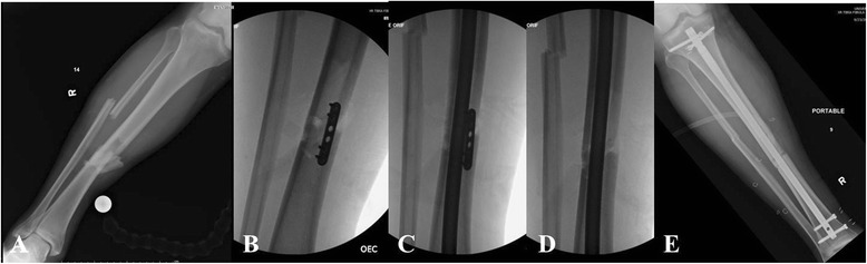 Fig. 9