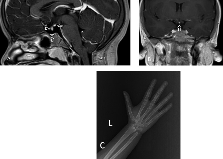 Fig 1