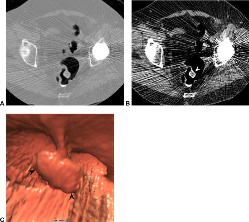 Figure 13