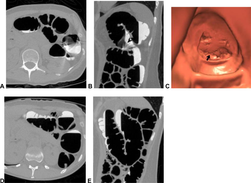 Figure 14