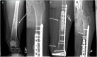 Fig. 9