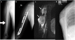 Fig. 10