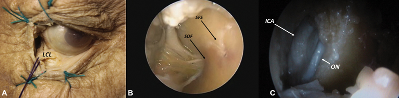 Fig. 4