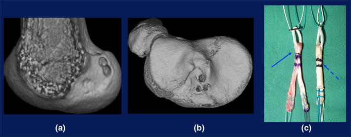 Fig. 14