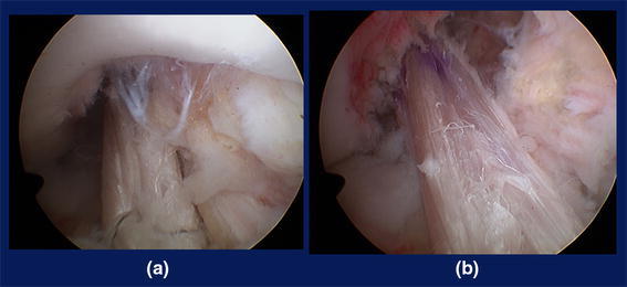 Fig. 16