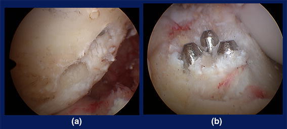 Fig. 15