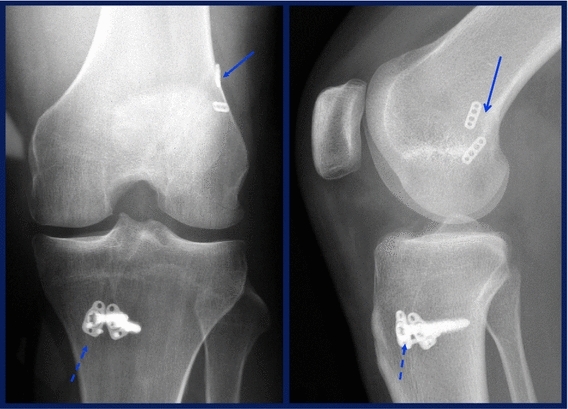 Fig. 17