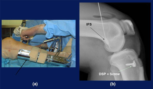 Fig. 11